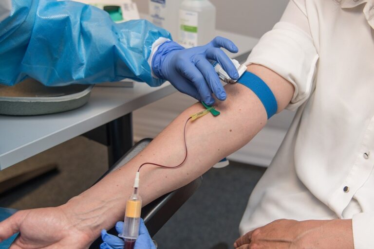 Pacientes Post Covid sí pueden donar sangre